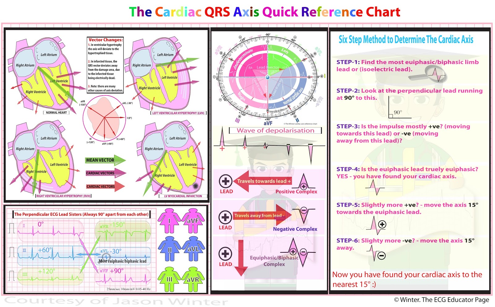 Ecg Educator Blog 021016