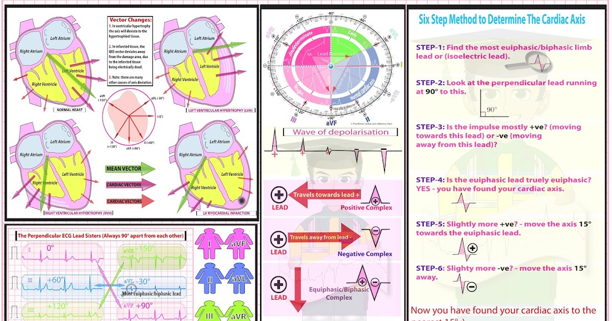 ECG Educator Blog Cardiac Axis Made Easy