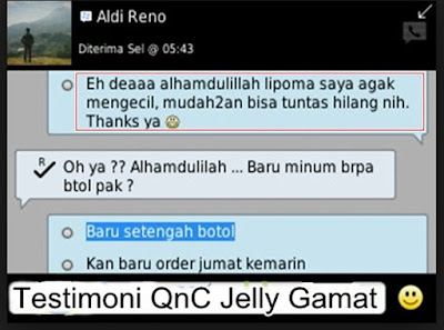 Cara Menghilangkan Lipoma Tanpa Operasi Sampai Tuntas Cara Menghilangkan Lipoma Tanpa Operasi Sampai Tuntas