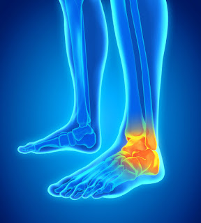 omclinic-jamnagar-physiotherapy-ankle-pain