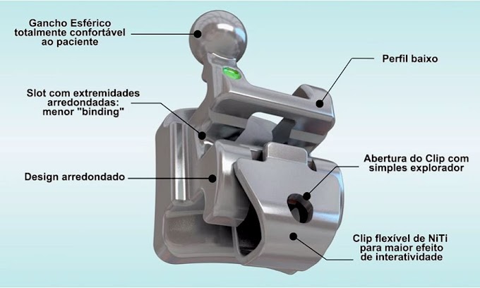 MATERIAIS DENTÁRIOS: Bráquete Autoligado Roth Sli - Morelli