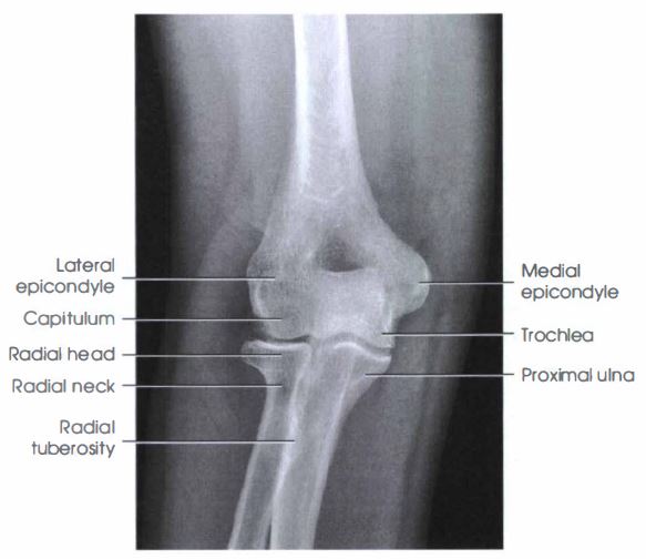 ELBOW : AP PROJECTION - RadTechOnDuty