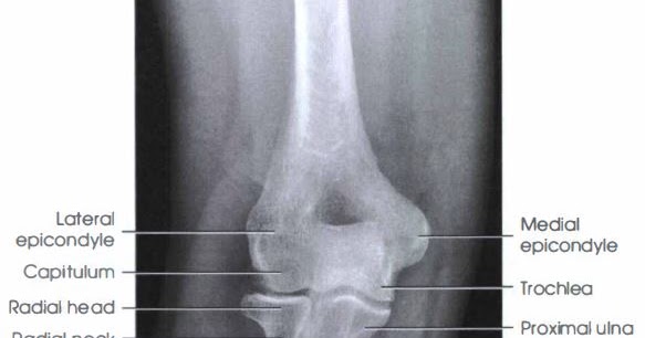 ELBOW : AP PROJECTION - RadTechOnDuty