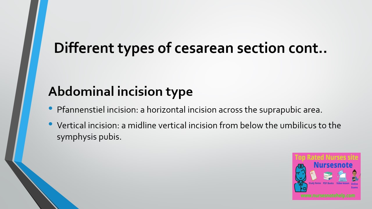 Cesarean Delivery or Cesarean Section Types, Indications, Management