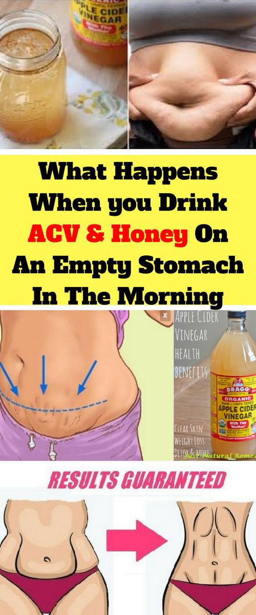 Drink Apple Cider Vinegar And Honey In The Morning On An