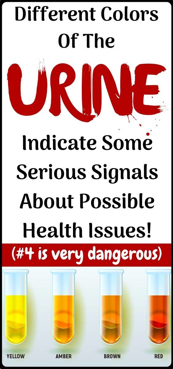 What all the colors of your urine and frequent urination can tell you