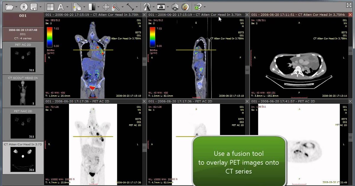Radiant Dicom Viewer 4.2.1 Crack Radiant Dicom Viewer 4.2.1 Crack