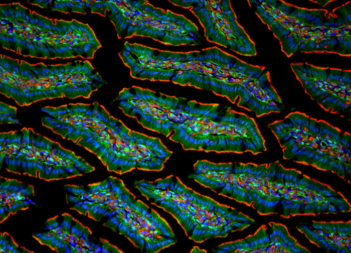 Photomicrography can also be an art!顯微鏡攝影: Gut of transgenic GFP rat ...