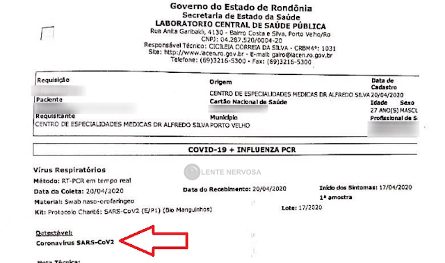 MAIS UM – Após passar por UPA´s e CEM, morador da zona leste é positivado com Coronavírus 2 MAIS UM – Após passar por UPA´s e CEM, morador da zona leste é positivado com Coronavírus