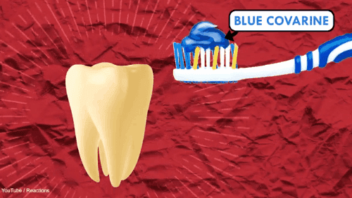 Nguyên nhân sâu răng ở trẻ em