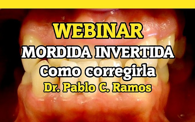 WEBINAR: Como corregir una Mordida Invertida - Dr. Pablo C. Ramos (Video 1)