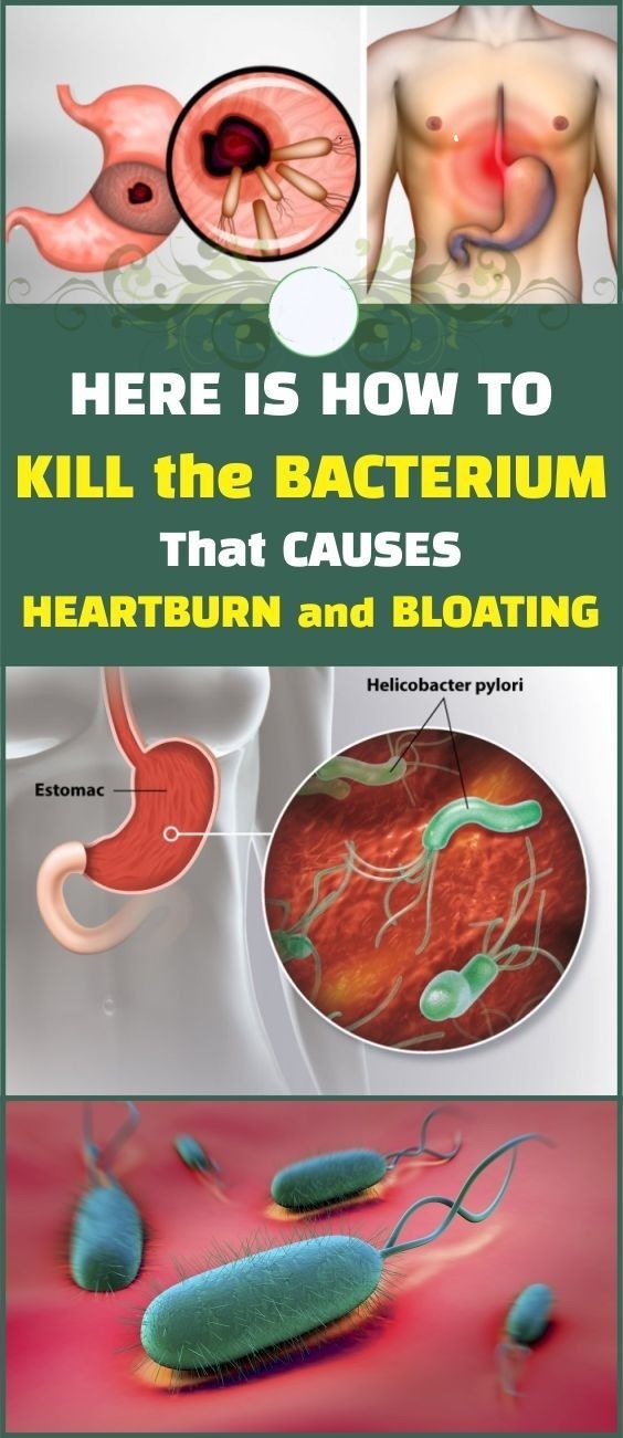 Here Is How to Kill the Bacterium That Causes Heartburn and Bloating