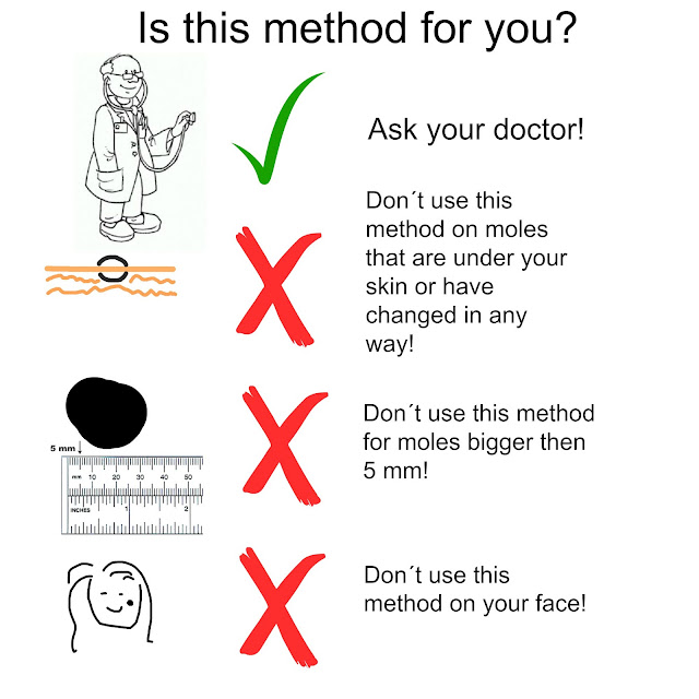 How to remove a mole yourself!