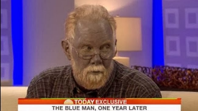 colloidial silver blue skin colloidial silver blue skin