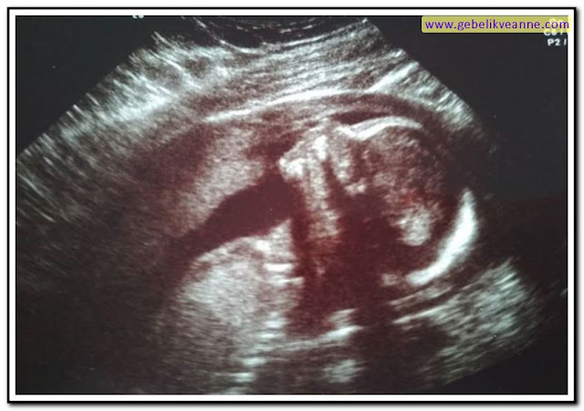 22 haftalık hamilelik ultrason