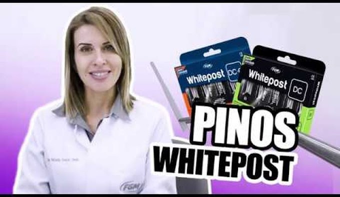 PINOS DENTÁRIOS: Técnica de cimentação com os pinos de Fibra de Vidro White Post da FGM