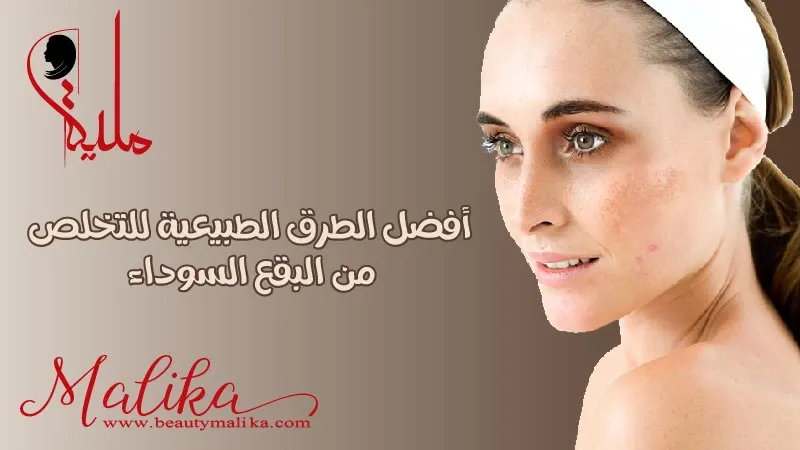 أفضل الطرق الطبيعية للتخلص من البقع السوداء في الوجه