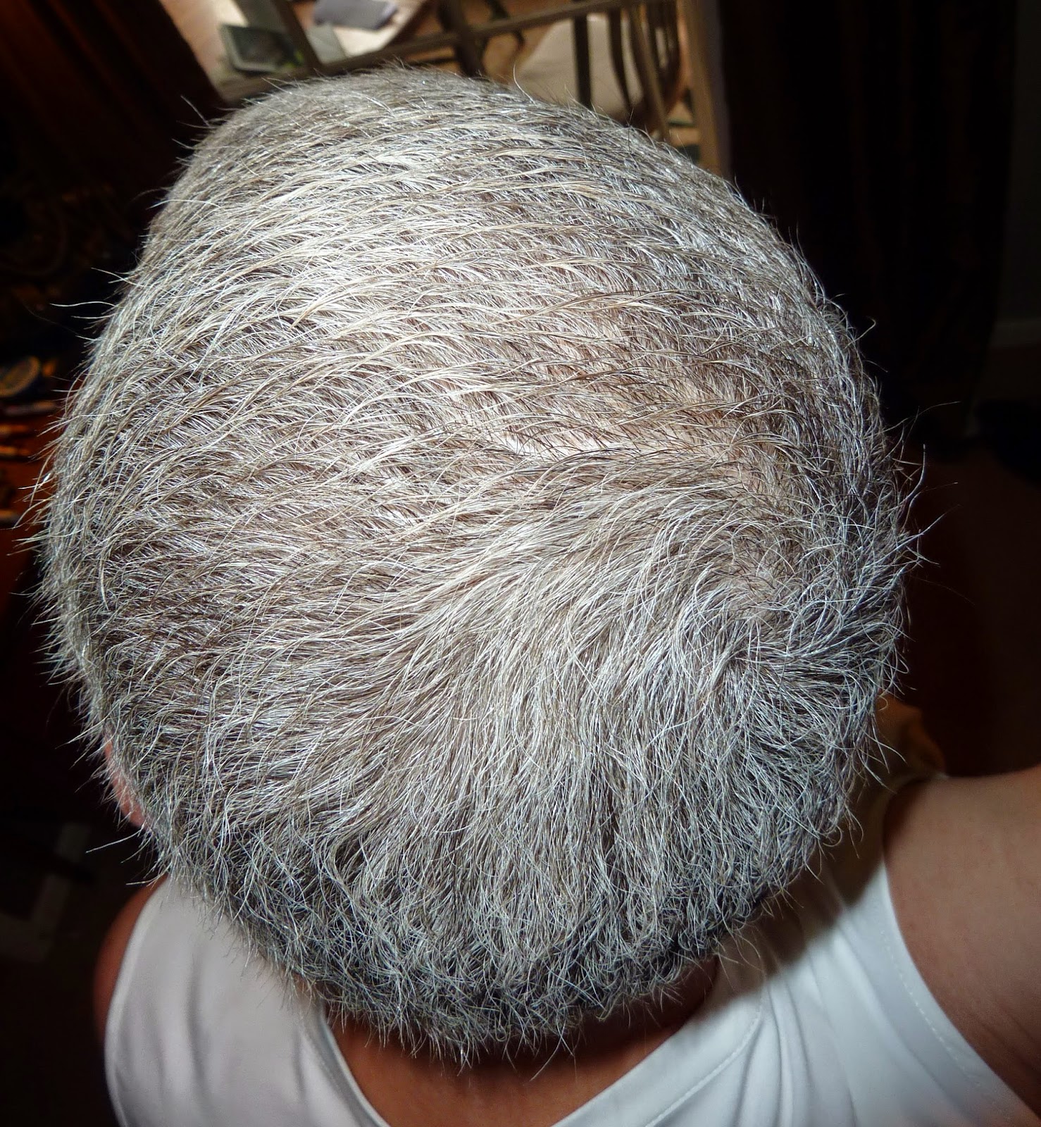 Anncredible: Hair Growth Progression after Chemo- Six Months with UPDATE!