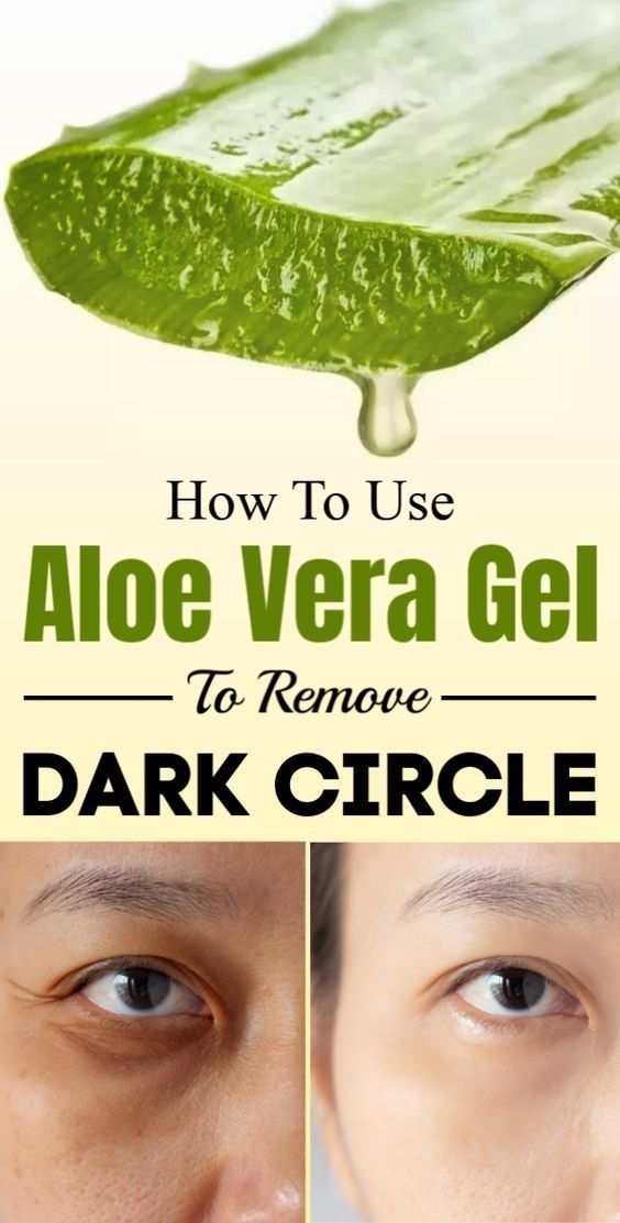 How To Use Aloe Vera Gel To Remove Dark Circle Fast Wellness s