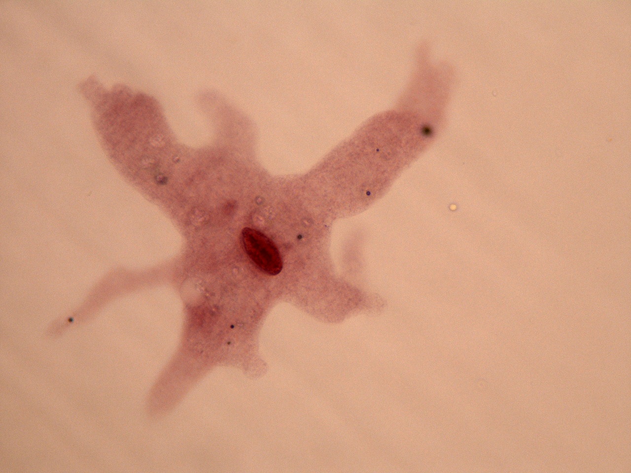 Bio Pics: Kingdom Protista