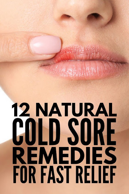 Fast And Effective 12 Natural Cold Sore Remedies That Work Wellness Days