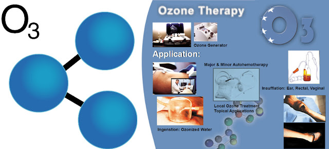 Máy tạo Ozone 10G khử trùng
