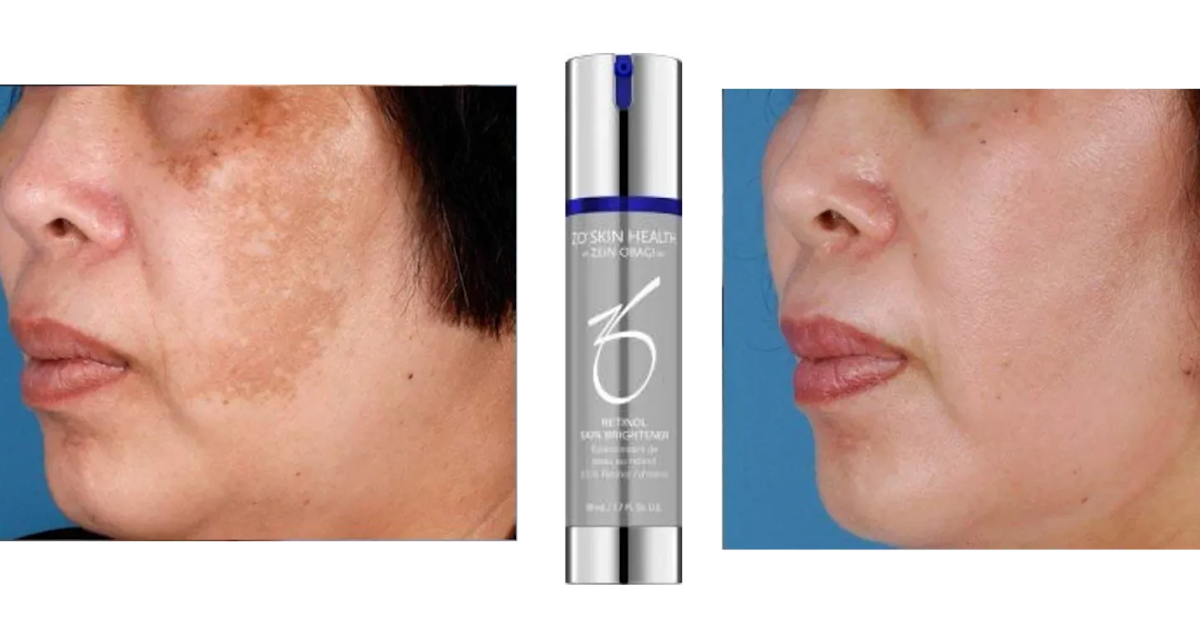 ZO SKIN HEALTH RETINOL SKIN BRIGHTENER 0.5 50 ML / 1.7 FL. OZ. U.S.