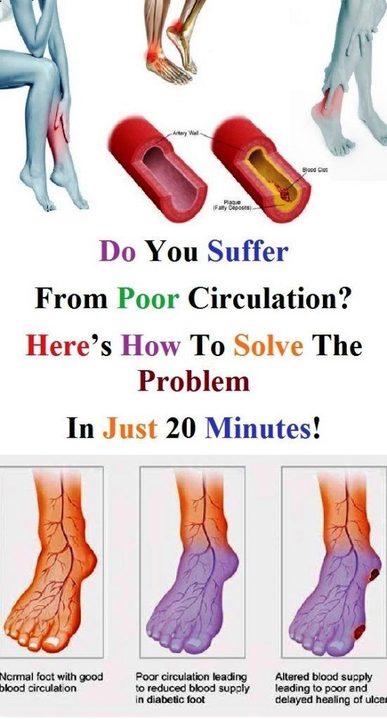 Do You Suffer From Poor Circulation? Here’s How To Solve The Problem