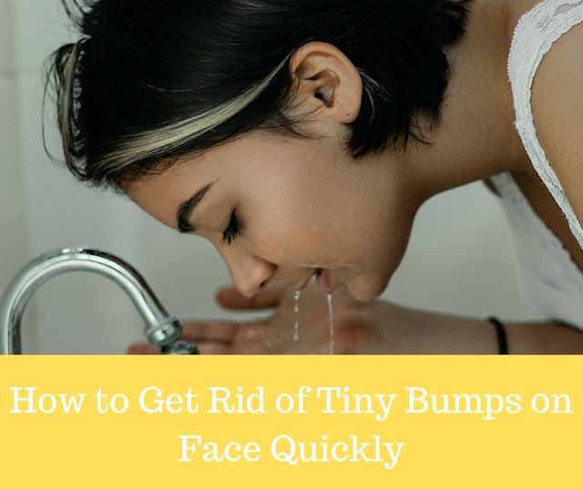 How to get rid of tiny bumps on face quickly home remedies to get rid of tiny bumps on face quickly