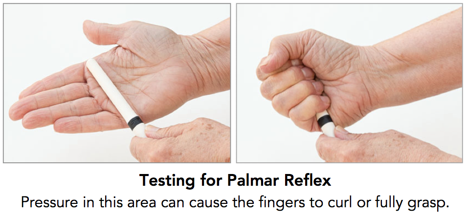 Palmar grasp reflex - Wikipedia