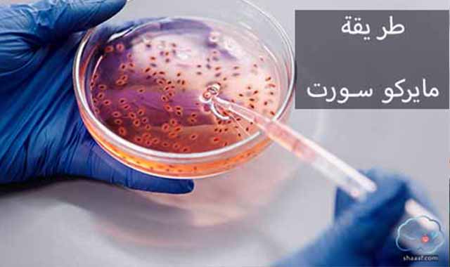 طريقة مايركو سورت تحديد جنس المولود طريقة مايركو سورت تحديد جنس المولود