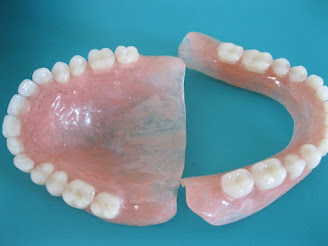 Denture Base Materials For Complete Denture  . Cheap Teeth Whitening, Buy Quality Beauty & Health Directly From China Suppliers:1Set Dental Materials Dental Sucker Denture Plate Retention For Full Upper Denture Or Acrylic Partial Denture Enjoy Free Shipping Worldwide!