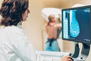 Screening Mammogram CPT Code