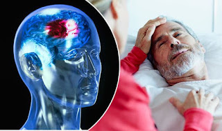 Obat Stroke Non Hemoragik, Cara Mengobati Stroke Biasa, Obat Stroke Non Hemoragic, Menyembuhkan Orang Stroke, Cara Mengobati Gejala Penyakit Stroke, Tempat Pengobatan Stroke Di Jakarta, Obat Tradisional Untuk Penyakit Stroke Ringan, Obat Stroke Laminine, Obat Penyakit Stroke Ringan, Obat Stroke Buah, Cara Terapi Penyakit Stroke Ringan, Cara Mengobati Stroke Dengan Herbal, Penyakit Stroke Panas, Obat Herbal Untuk Pasien Stroke, Obat Alami Buat Penyakit Stroke 