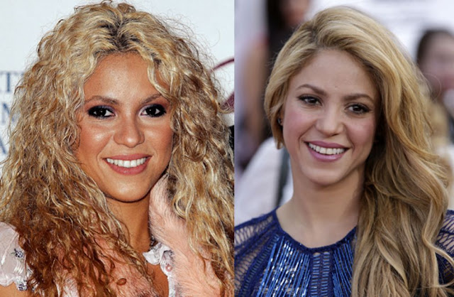 Cómo se volvió Shakira blanca? - Quora