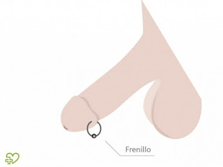 piercing frenillo 580x435 - El piercing genital en los hombres -