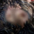 Mãe de menina com larvas na cabeça está com medo de ser linchada