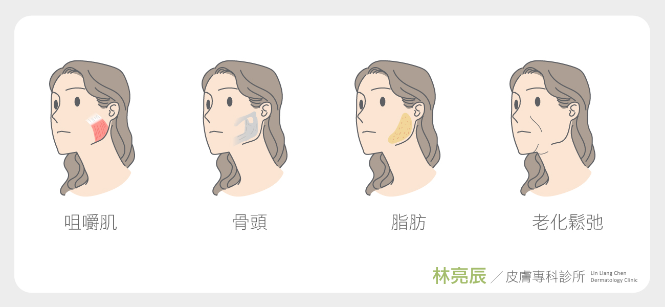 玻尿酸晶亮瓷微晶瓷微整形3D聚左旋乳酸舒顏萃液態拉皮洢蓮絲sculptra舒顏萃價格一瓶幾cc膠原蛋白增生劑按摩淚溝費用額頭法令紋晶亮瓷價格晶亮瓷微晶瓷差別維持晶亮瓷下巴晶亮瓷隆鼻林亮辰皮膚專科診所林亮辰醫師新竹推薦醫師皮膚科醫師