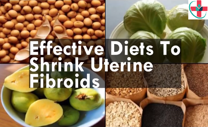 See how fibroid can be solved by changing our diet