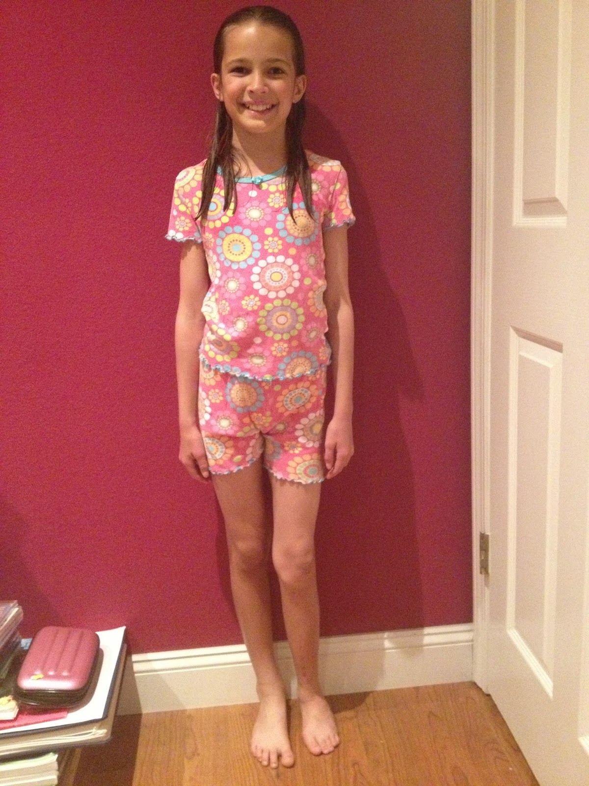 fibular hemimelia leg lengthening: One Year Anniversary