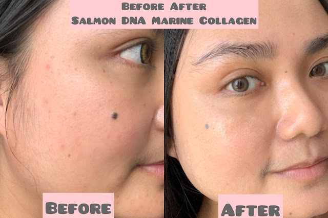 SOMETHINC SALMON DNA MARINE COLLAGEN ELIXIR REVIEW SOMETHINC SALMON DNA MARINE COLLAGEN ELIXIR REVIEW