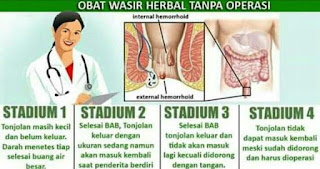 Jual Obat Wasir Ambeien Manjur Tanpa Operasi di Kota Semarang