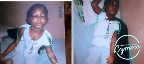 unnamed Photos: Lady shares photos of her little cousin who was allegedly battered by her guardian in Abuja