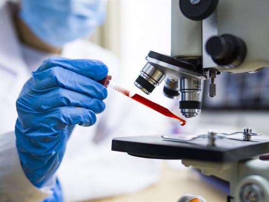 Κορωνοϊός: Τι είναι ο κρίσιμος δείκτης διασποράς k - Γιατί «μπερδεύει» τους επιστήμονες