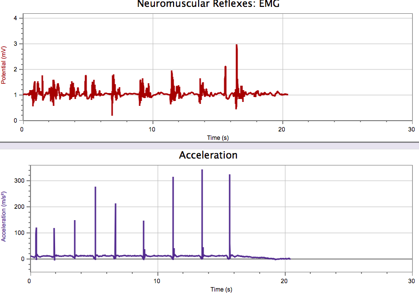 Human Anatomy & Physiology Reflex Lab