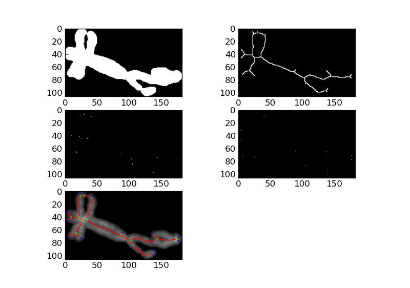 DIP4FISH Detecting end points in a skeleton