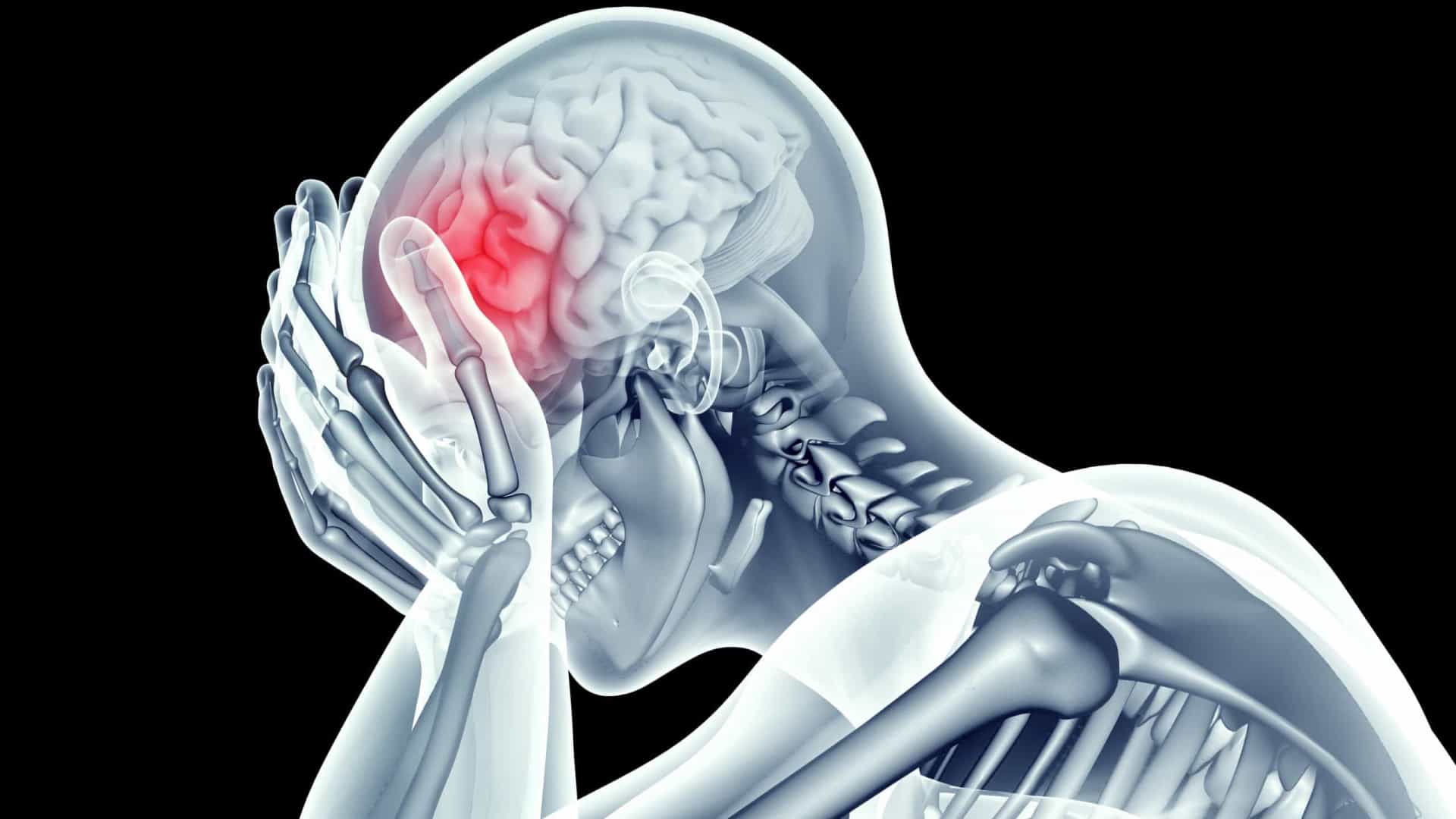 Acidente Vascular Cerebral: grande problema de saúde pública mundial. Por Walace Leal