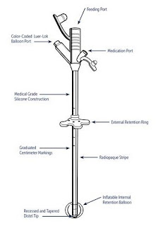 Anatomy of a feeding tube