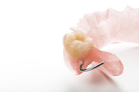 dentadura acrílica