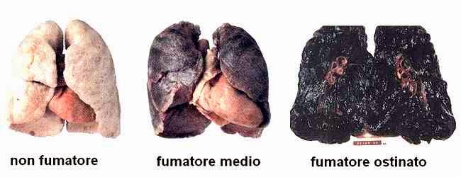 Come agevolare uno stato dopo ha smesso di fumare